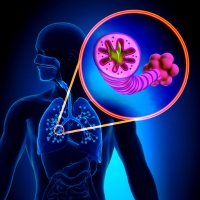 COPD - Smoking Related Issues