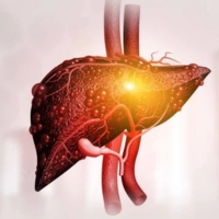 Liver Diseases