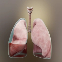 Pleural Effusions